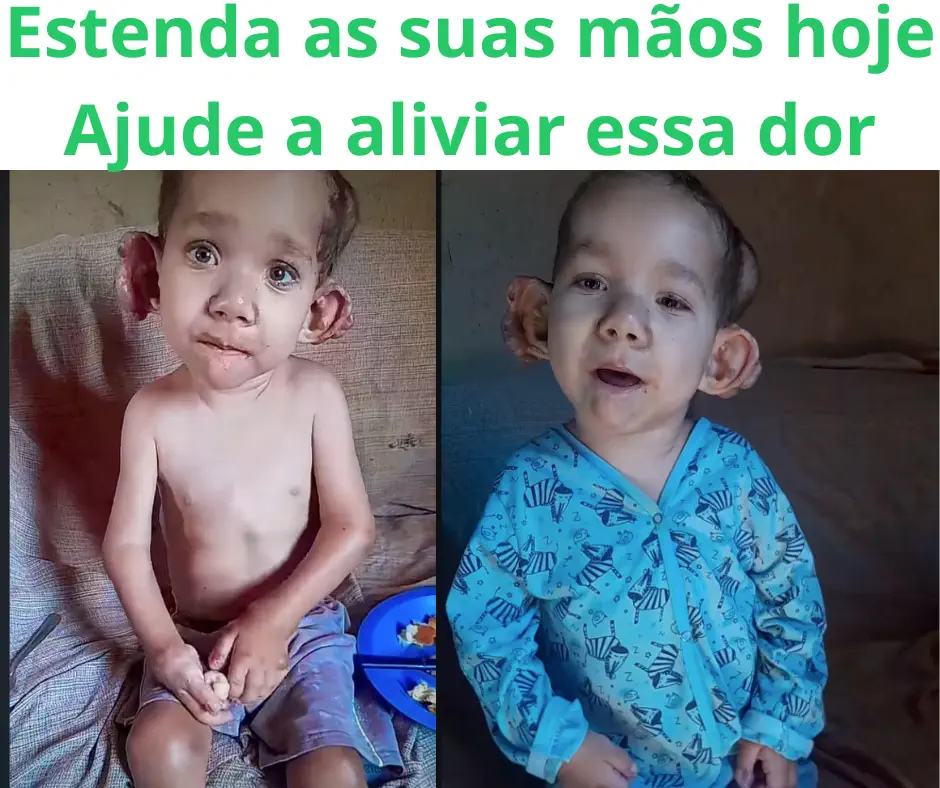 Pedro, menino de 4 anos em tratamento